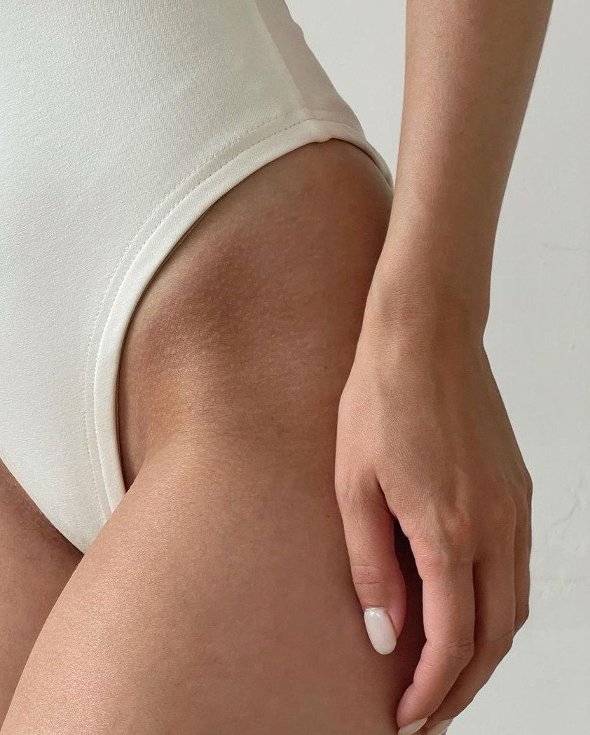 Smooth, even skin on legs and body after stretch mark revision treatment at Be Beauty Cosmetic Clinic Auckland
