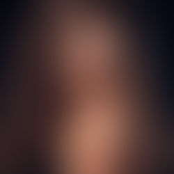 Exosomes Treatment: The Next Generation of Skin & Hair Rejuvenation