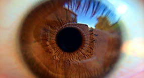 Eye
