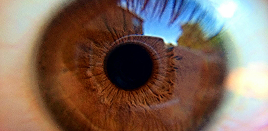 Eye