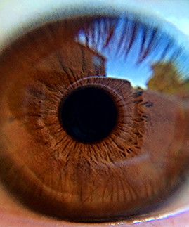 Eye