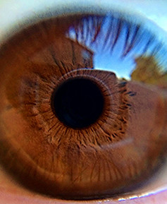 Eye