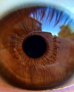 Eye
