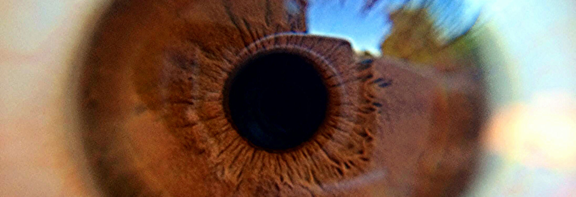 Eye