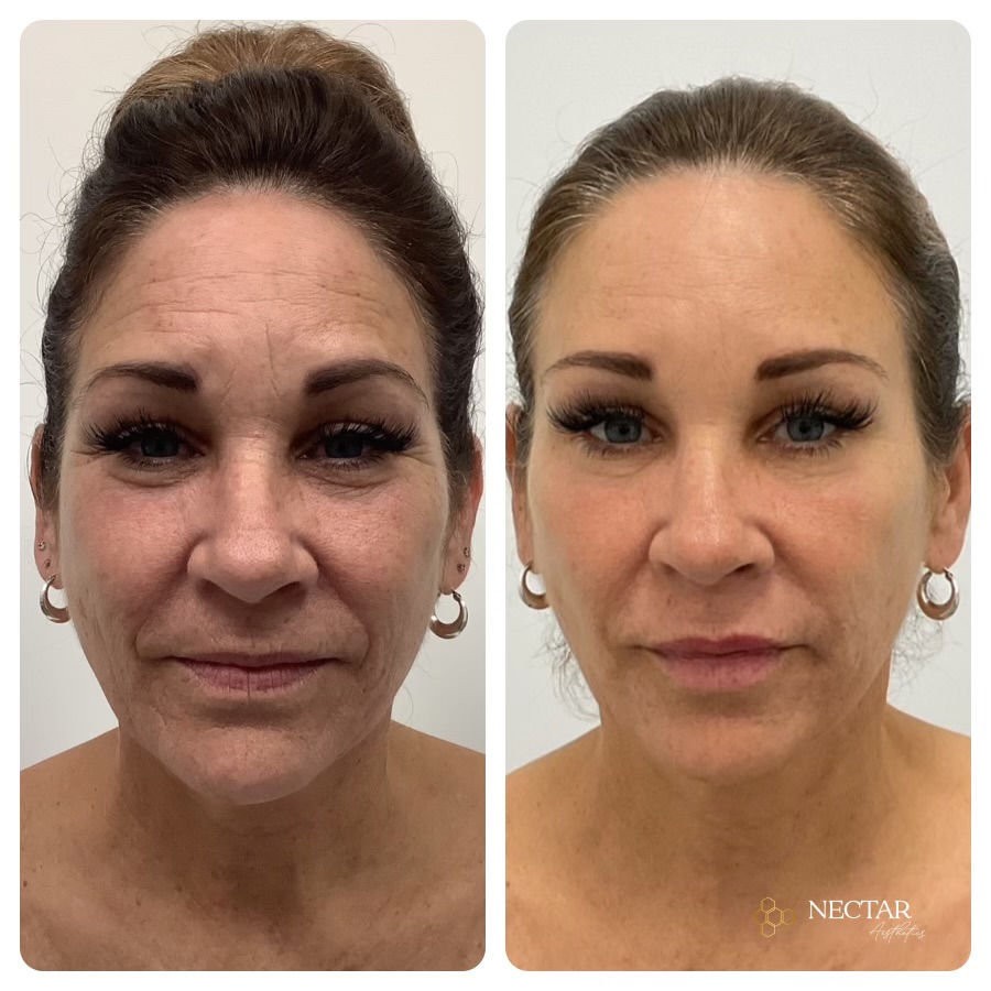 Nectar Aesthetics Med Spa - Orlando