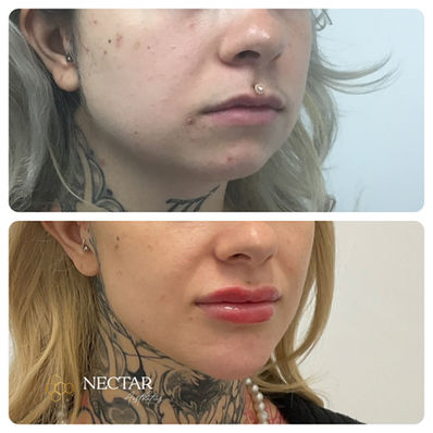 jawline sanford patient