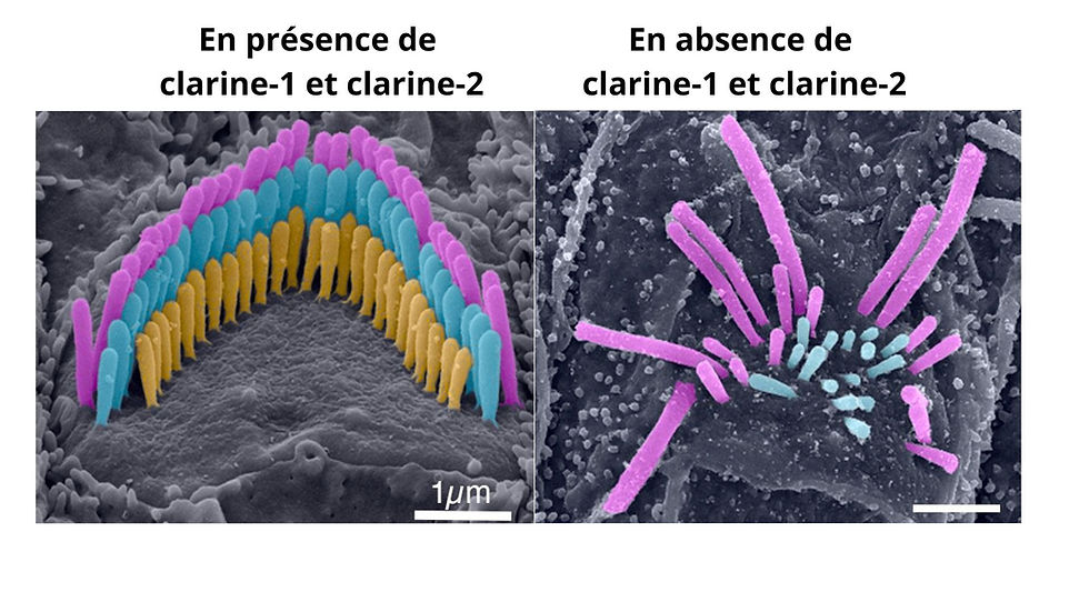Vers une meilleure compréhension des origines des variabilités phénotypiques du syndrome de Usher de type 3 
