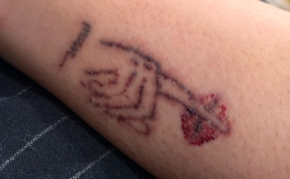 Odstránenie tetovania: prečo je niekedy self-care aj „uberať“