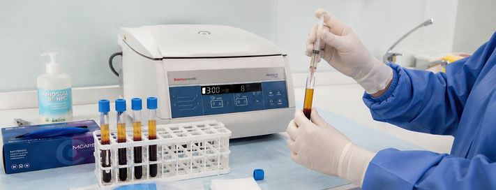 Ecógrafo SonoScape E2 Pro y centrífuga Thermo Medifuge utilizados para PRP ecoguiado