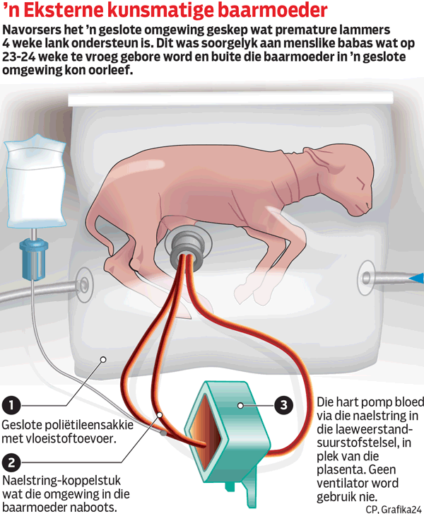 External artificial womb