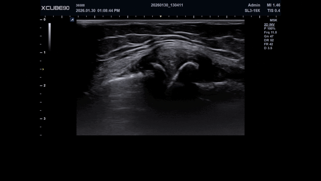 202602050721 (1) (2) (1).gif