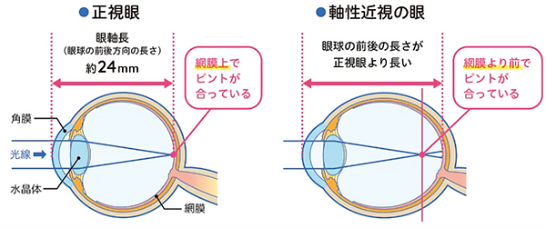 元木町眼科 小田栄院 点眼治療