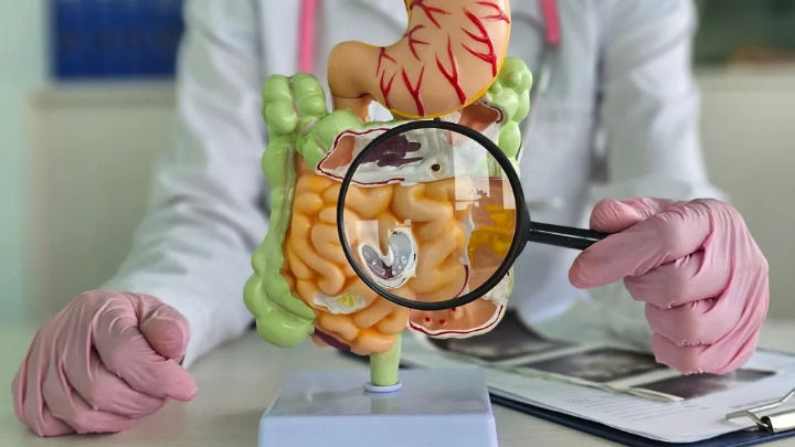 Omvoh logra mantener remisión sin esteroides durante tres años en pacientes con enfermedad de Crohn Omvoh logra mantener remisión sin esteroides durante tres años en pacientes con enfermedad de Crohn