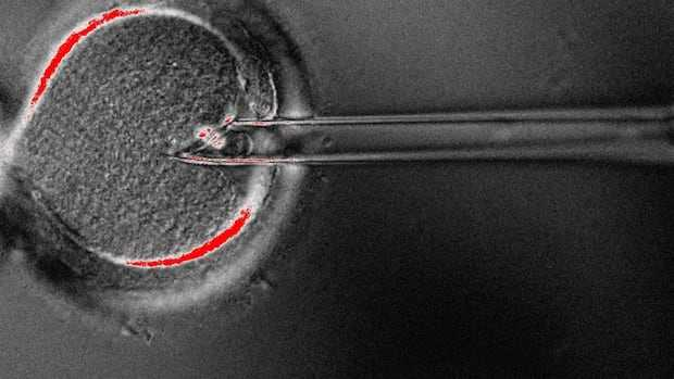 in vitro fertilization