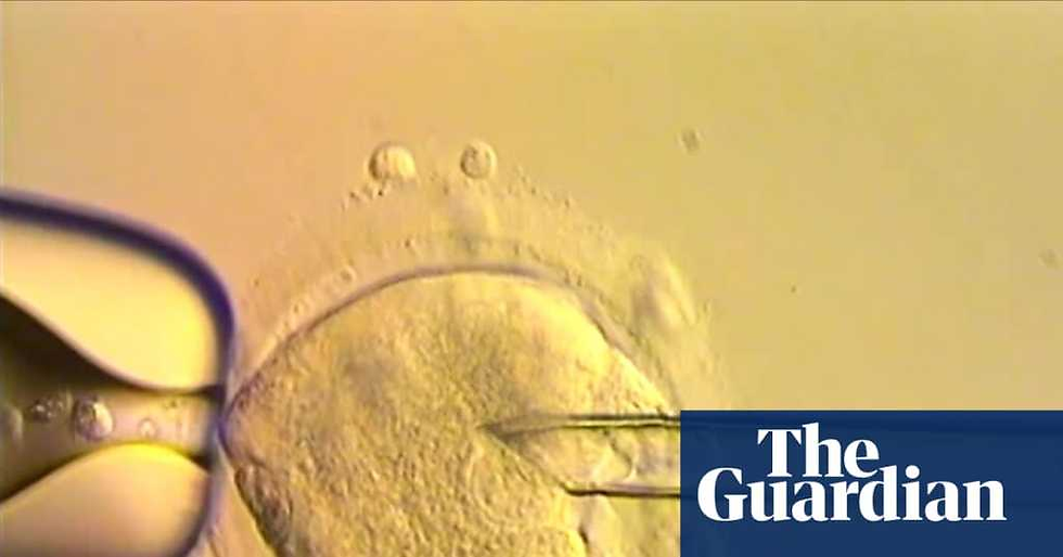 in vitro fertilization