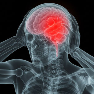 A medical image shows a grey-toned skull and partial skeleton against a black background. The brain is visible in bright red, indicating potential pain or activity, with hands on the head.