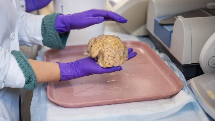 This scene shows a person in a white lab coat and purple gloves carefully holding a real human brain over a pink tray, inside what appears to be a medical laboratory or classroom.