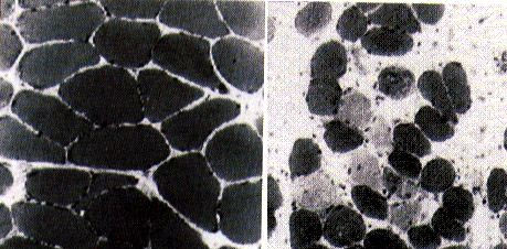 Musles in Earth in in Space.jpeg