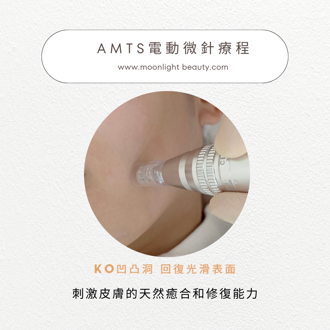AMTS電動微針療程