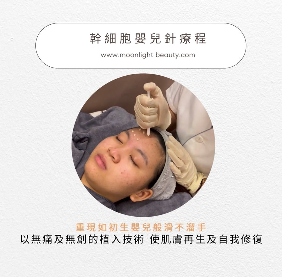 幹細胞嬰兒針療程