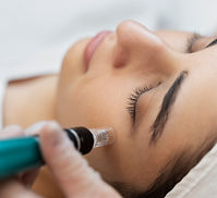 Microneedling