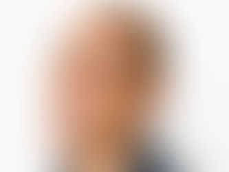 ¿Cómo me vería con la cabeza rapada?