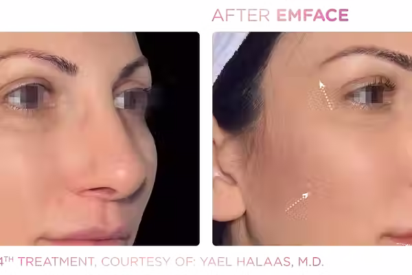 Emface_PIC_Ba-card-female-face-048_ENUS101.avif