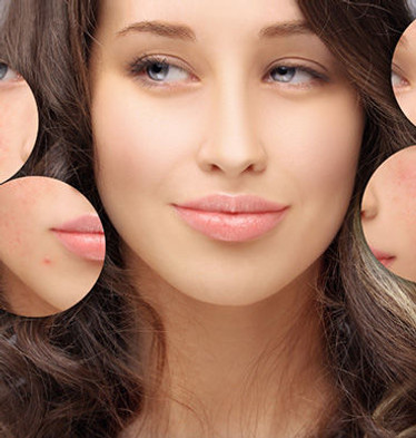 Dermaplaning-dunes-pi.jpg