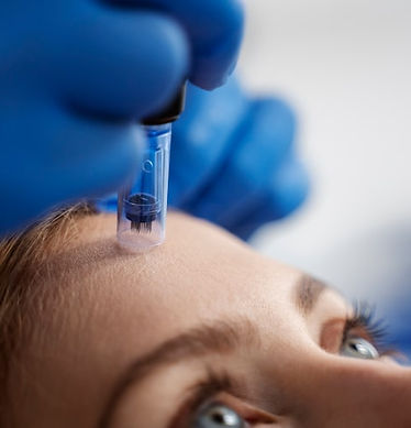 patient-undergoing-microneedling-procedure_23-2149374074.jpg