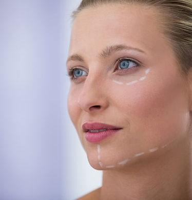 woman-with-marks-drawn-cosmetic-treatment_107420-74114.jpg