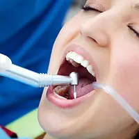 dental-cleanings-02.webp