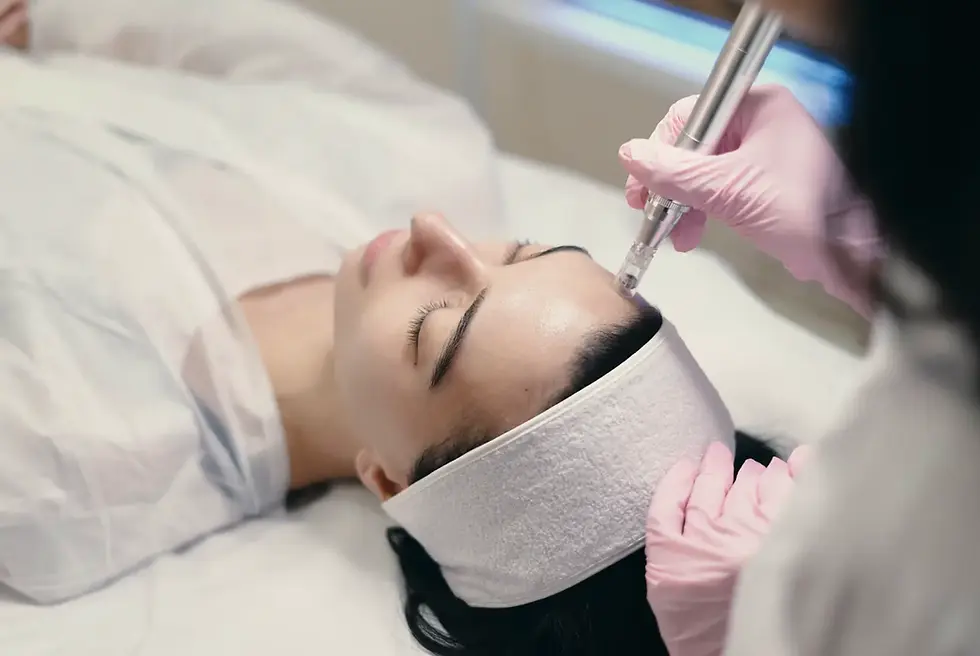 PRF Microneedling: Why It's Safe for All Seasons — Including Summer