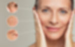 Wrinkles, crepiness, hyperpigmentation and laxity are seemingly inevitable signs of aging.