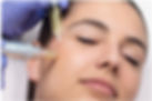 Microneedling in Snellville,Ga_edited.jpg