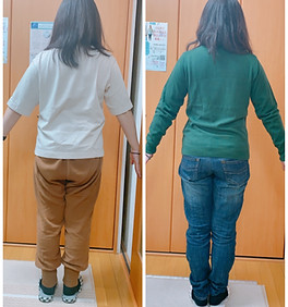 笑顔の可愛いママさんビフォーアフター3