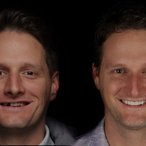 Smile Transformation