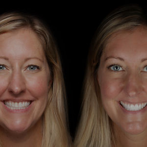 Smiling Women
