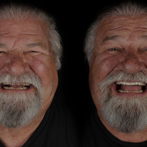 Natural Smiles