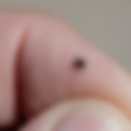 Deer tick that can carry Lyme disease