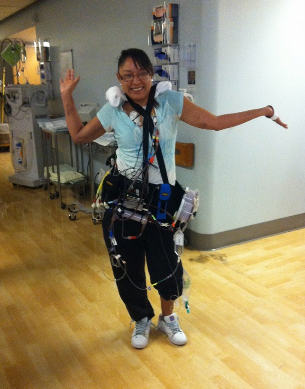 Patient wearing a portable dialysis machine. Currently not at the size we would like to see, but the technology is advancing rapidly.