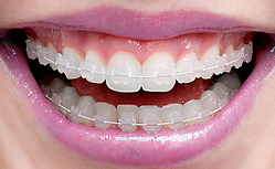 ICERAM_SORRISO.png