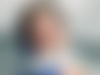 Getting custom veneers at Meng Dental