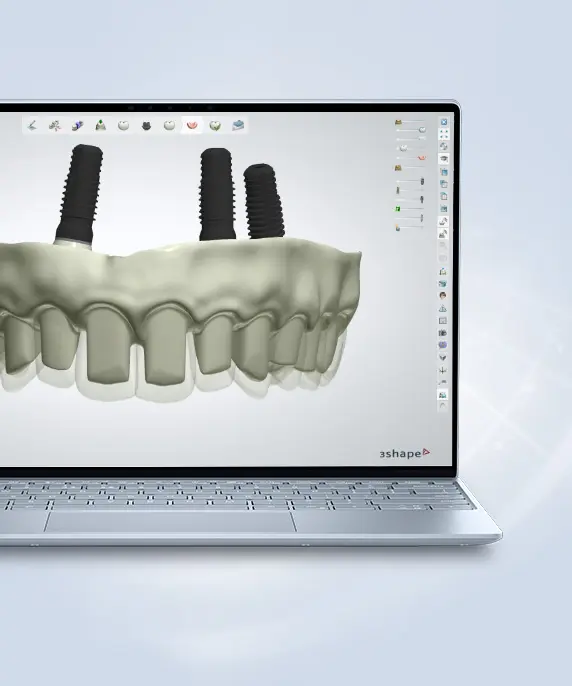 DS22 implant bridge.webp