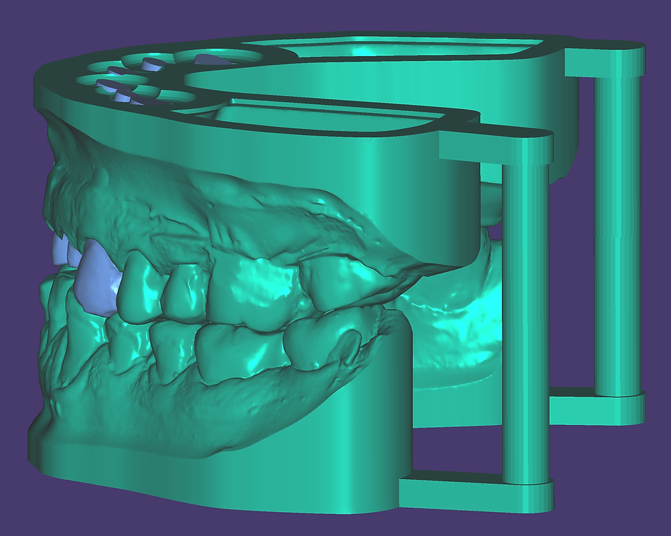 Miniaturbild: exocad MODEL CREATOR Add-On-Modul Kauf