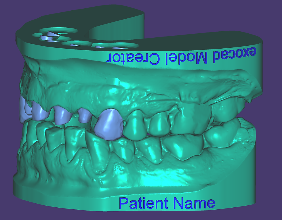Miniaturbild: exocad MODEL CREATOR Add-On-Modul Kauf