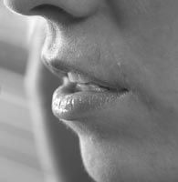 Adult Speech Disorders