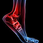 Ankle injuries