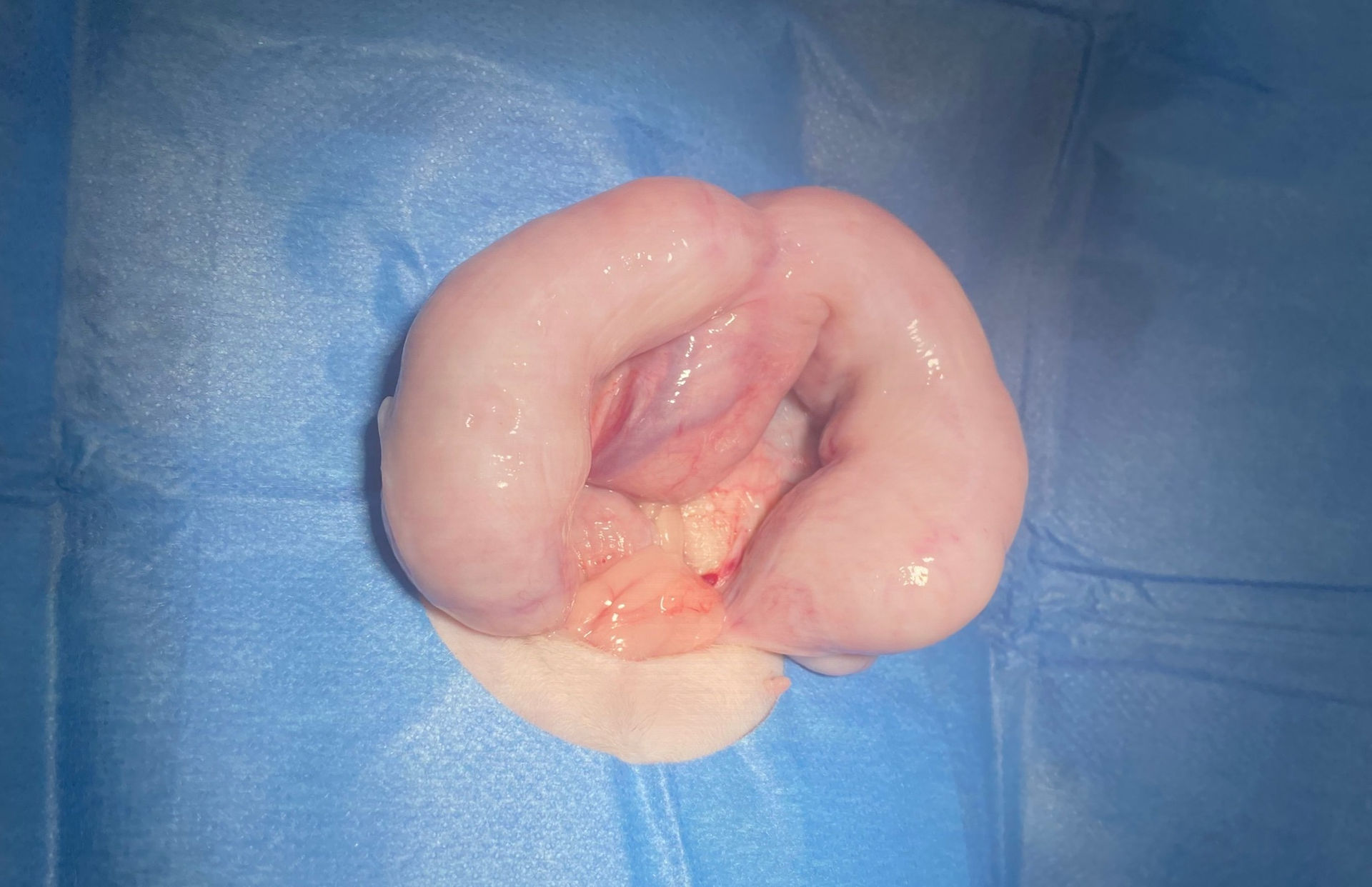 Pyometra - Enlarge Uterus filled with Pus