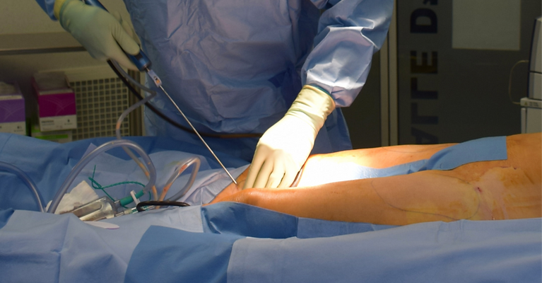 person in white medical scrub suit_edite