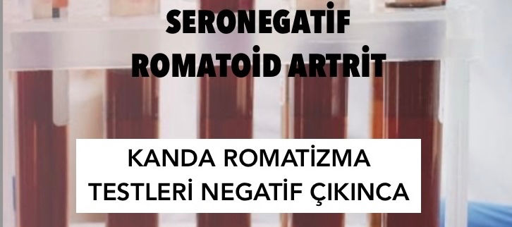 Romatizma testlerinizin normal çıkmasına rağmen Romatoid Artrit olabilirsiniz